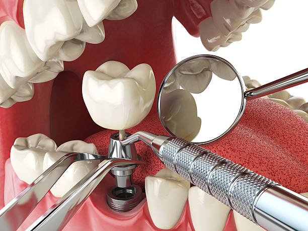 Best Broken or Cracked Tooth Emergency Dentist in Reinbeck, IA